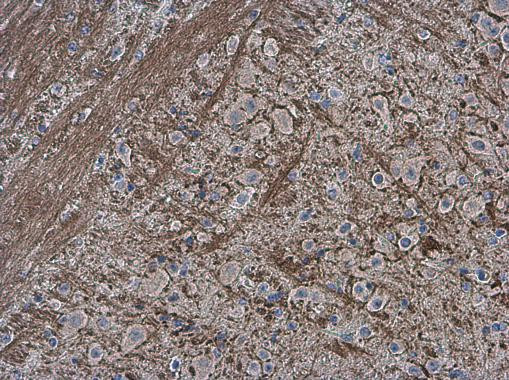 Collagen II Antibody in Immunohistochemistry (Paraffin) (IHC (P))