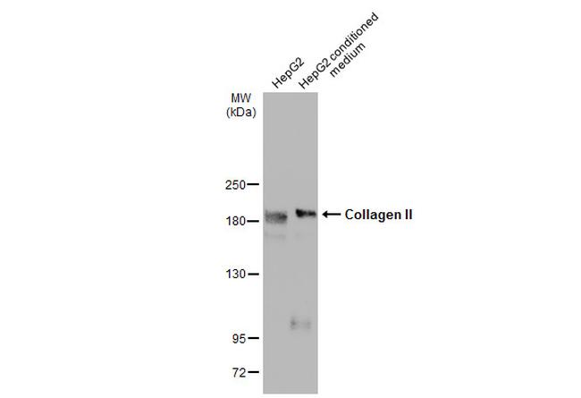 Collagen II Antibody in Western Blot (WB)