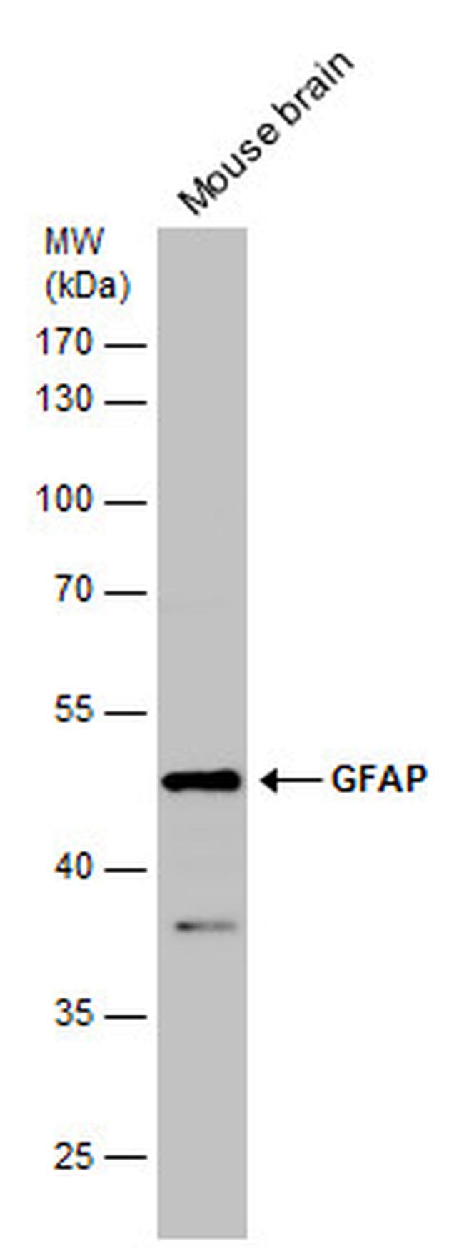 GFAP Antibody in Western Blot (WB)