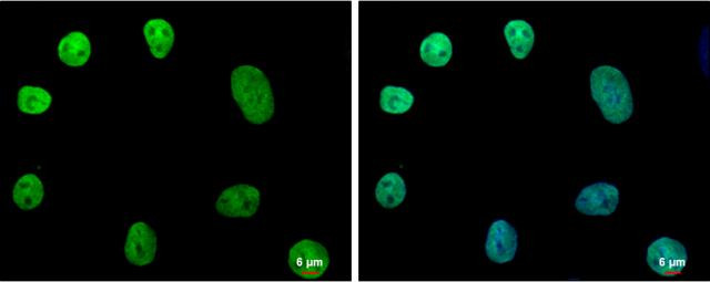 Nanog Antibody in Immunocytochemistry (ICC/IF)