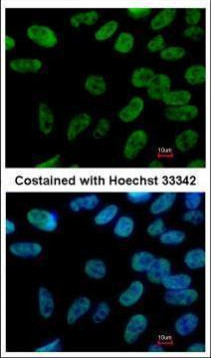 Nanog Antibody in Immunocytochemistry (ICC/IF)