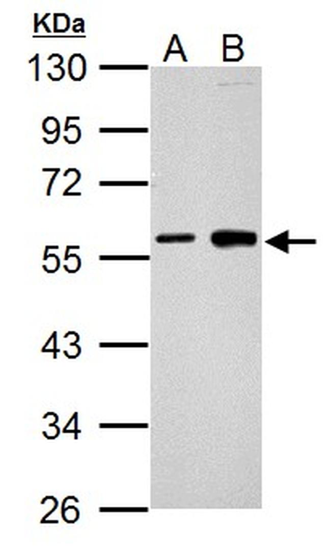 Cyclin B1 Antibody in Western Blot (WB)