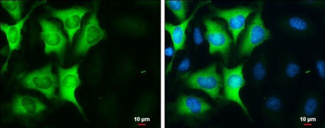 Cyclin B1 Antibody in Immunocytochemistry (ICC/IF)