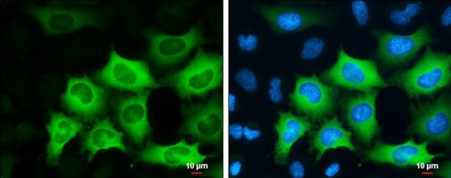 Cyclin B1 Antibody in Immunocytochemistry (ICC/IF)