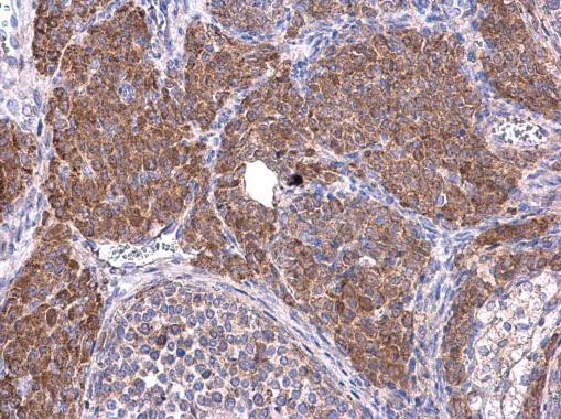 Cyclin B1 Antibody in Immunohistochemistry (Paraffin) (IHC (P))