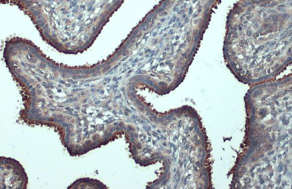 B-Raf Antibody in Immunohistochemistry (Paraffin) (IHC (P))