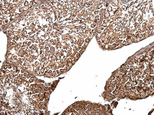 B-Raf Antibody in Immunohistochemistry (Paraffin) (IHC (P))