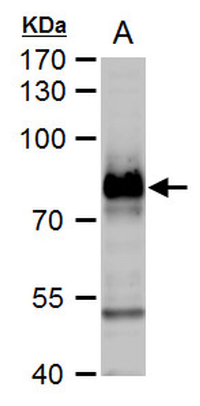 B-Raf Antibody in Western Blot (WB)