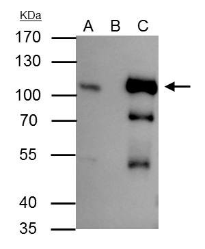 B-Raf Antibody in Immunoprecipitation (IP)