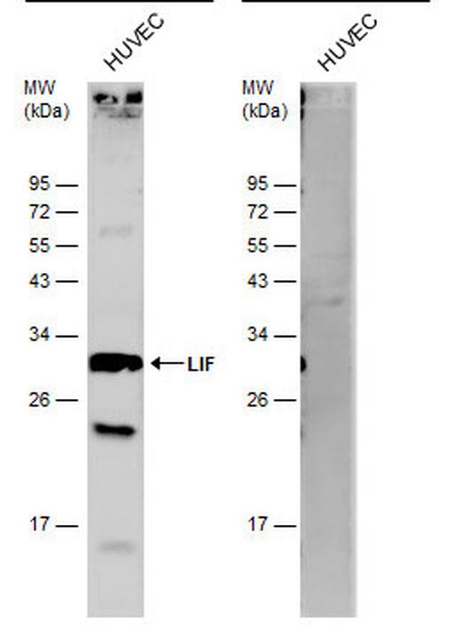 LIF Antibody in Western Blot (WB)