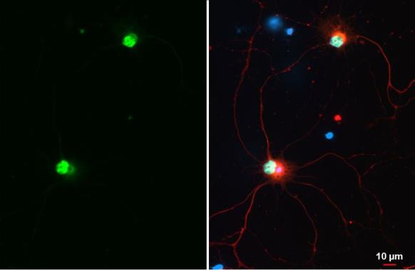 E6AP Antibody in Immunocytochemistry (ICC/IF)