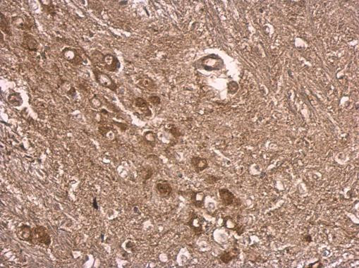 E6AP Antibody in Immunohistochemistry (Paraffin) (IHC (P))