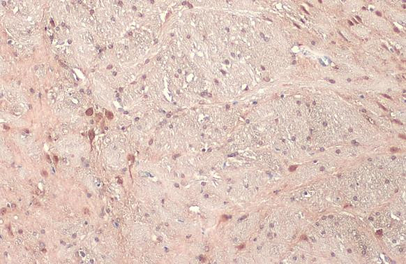 E6AP Antibody in Immunohistochemistry (Paraffin) (IHC (P))