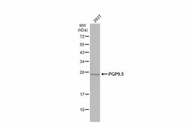 PGP9.5 Antibody in Western Blot (WB)