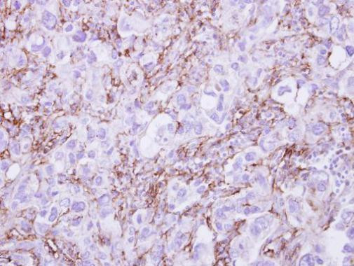 G6PD Antibody in Immunohistochemistry (Paraffin) (IHC (P))