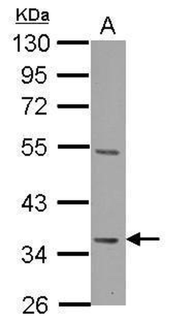 Decorin Antibody in Western Blot (WB)