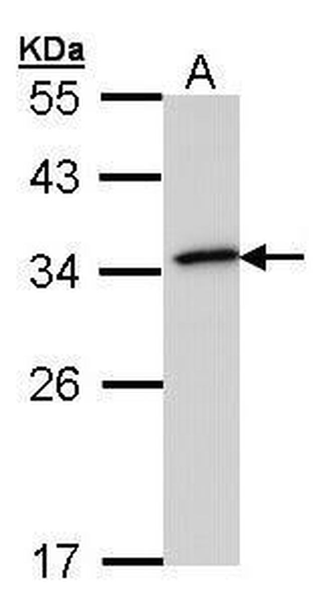 NQO1 Antibody in Western Blot (WB)