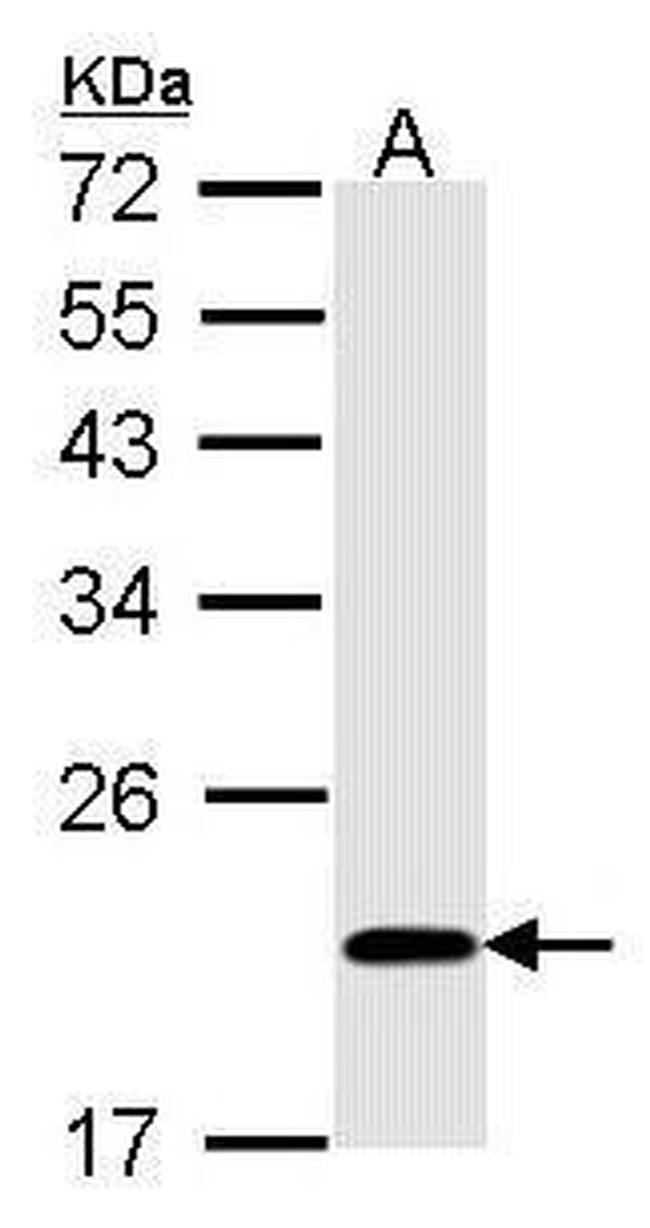 BID Antibody in Western Blot (WB)