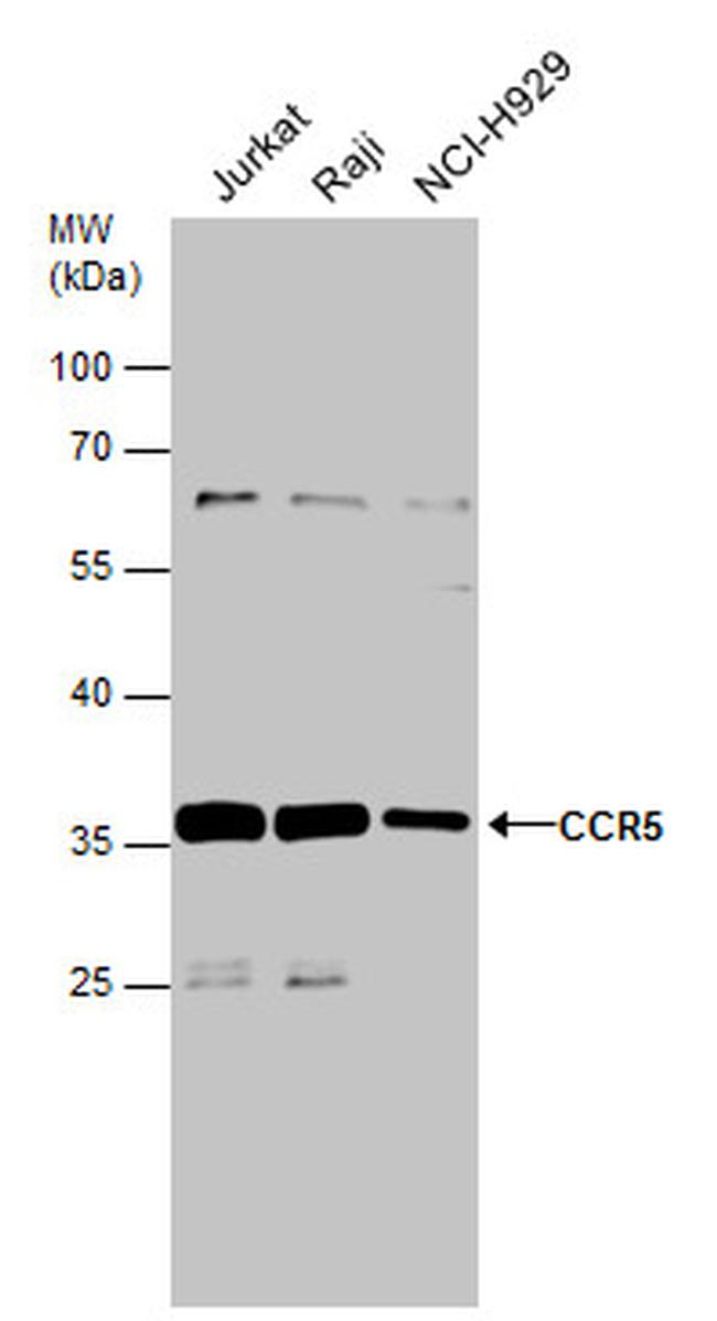 CCR5 Antibody in Western Blot (WB)