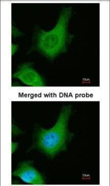 Calcium Sensing Receptor Antibody in Immunocytochemistry (ICC/IF)