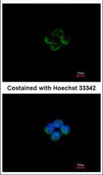 ACADM Antibody in Immunocytochemistry (ICC/IF)