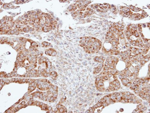 ACADM Antibody in Immunohistochemistry (Paraffin) (IHC (P))