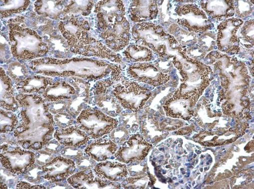 ACADM Antibody in Immunohistochemistry (Paraffin) (IHC (P))