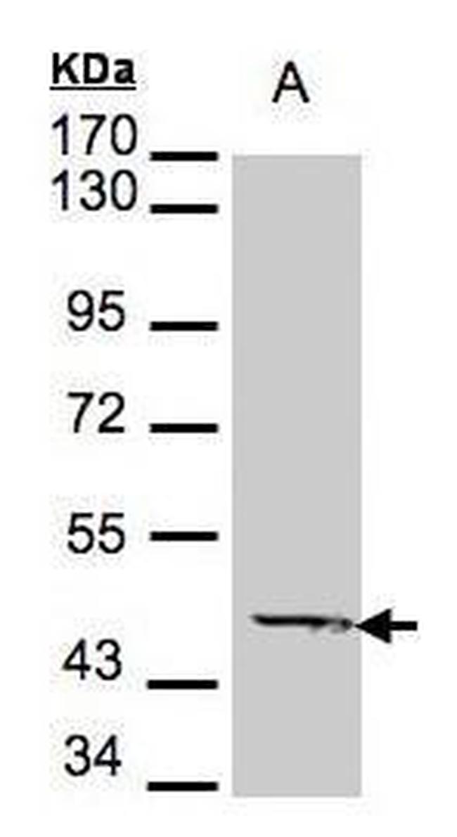 ACADM Antibody in Western Blot (WB)