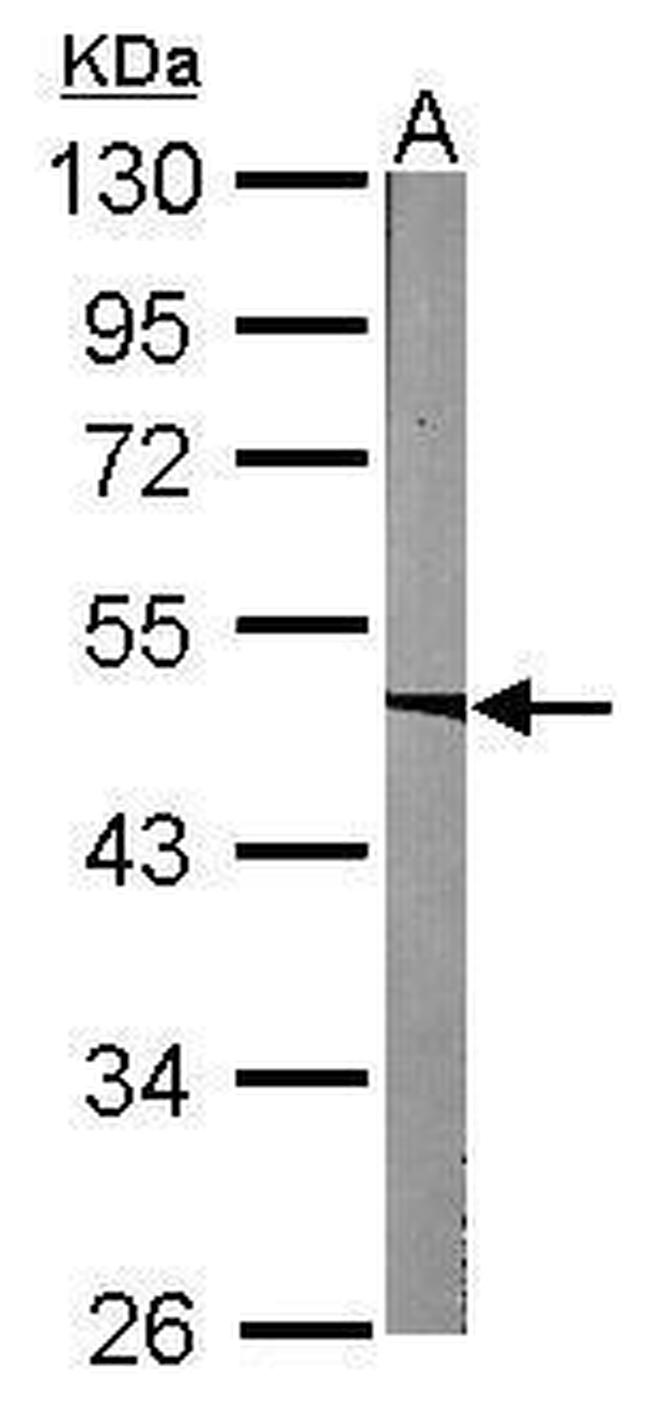 ACADM Antibody in Western Blot (WB)