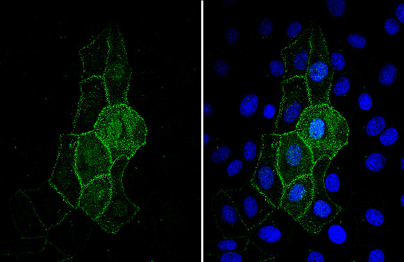 ACE2 Antibody in Immunocytochemistry (ICC/IF)