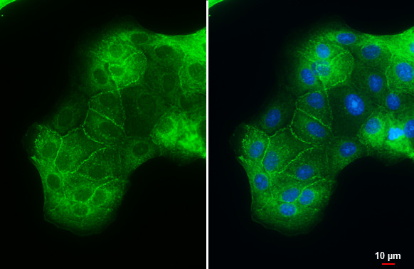 ACE2 Antibody in Immunocytochemistry (ICC/IF)