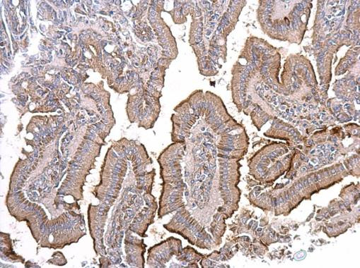 ACE2 Antibody in Immunohistochemistry (Paraffin) (IHC (P))