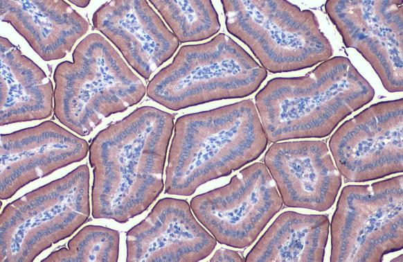 ACE2 Antibody in Immunohistochemistry (Paraffin) (IHC (P))