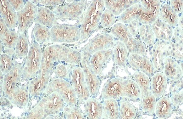 ACE2 Antibody in Immunohistochemistry (Paraffin) (IHC (P))