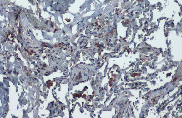 ACE2 Antibody in Immunohistochemistry (Paraffin) (IHC (P))