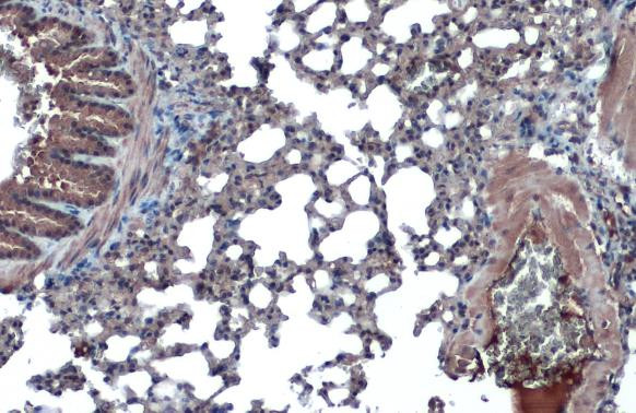 ACE2 Antibody in Immunohistochemistry (Paraffin) (IHC (P))