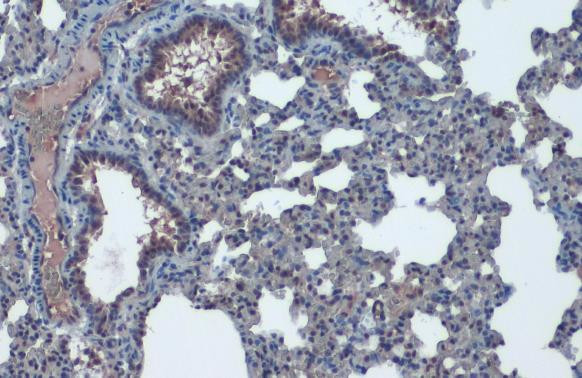 ACE2 Antibody in Immunohistochemistry (Paraffin) (IHC (P))