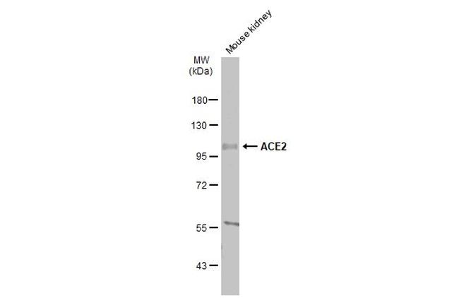 ACE2 Antibody in Western Blot (WB)