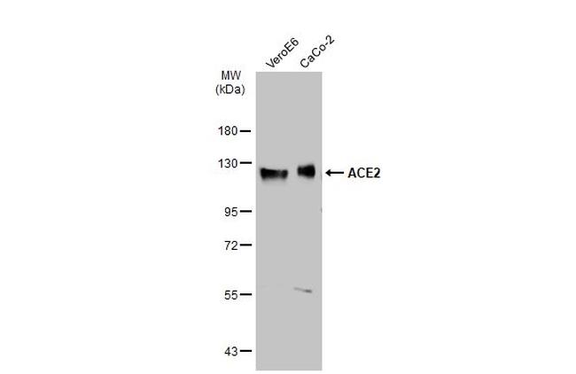 ACE2 Antibody in Western Blot (WB)