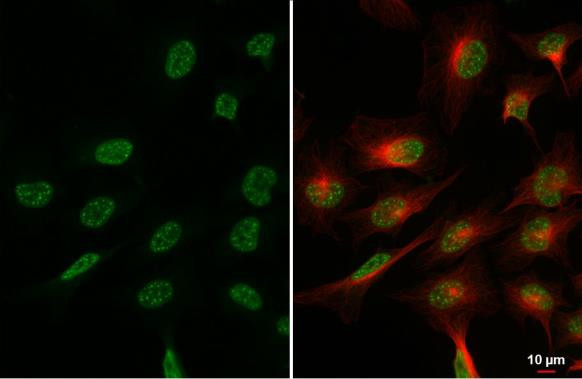 Blooms Syndrome Antibody in Immunocytochemistry (ICC/IF)