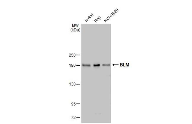 Blooms Syndrome Antibody in Western Blot (WB)