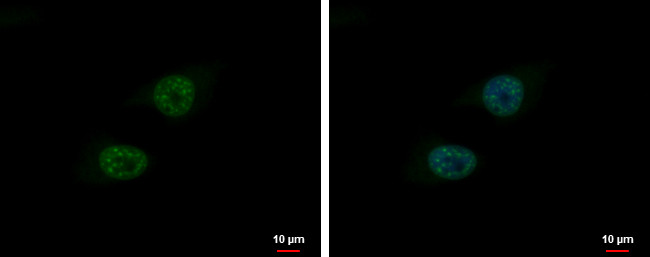 Blooms Syndrome Antibody in Immunocytochemistry (ICC/IF)