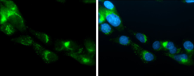 APOE Antibody in Immunocytochemistry (ICC/IF)