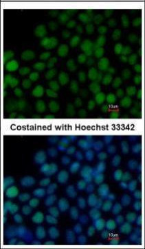 SOX2 Antibody in Immunocytochemistry (ICC/IF)