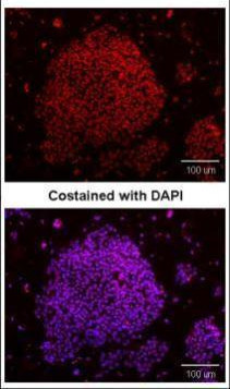 SOX2 Antibody in Immunocytochemistry (ICC/IF)