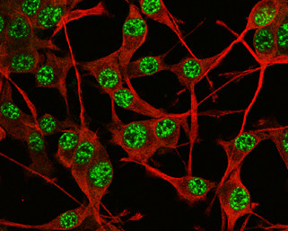 SOX2 Antibody in Immunocytochemistry (ICC/IF)