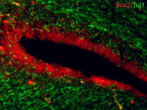 SOX2 Antibody in Immunohistochemistry (Frozen) (IHC (F))