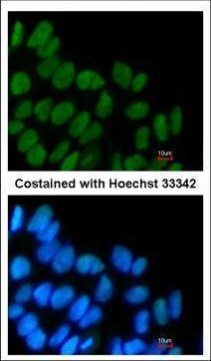 SOX2 Antibody in Immunocytochemistry (ICC/IF)