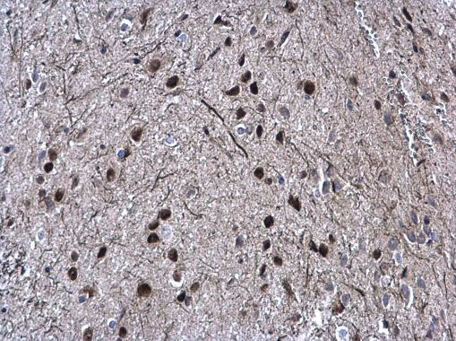 SOX2 Antibody in Immunohistochemistry (Paraffin) (IHC (P))