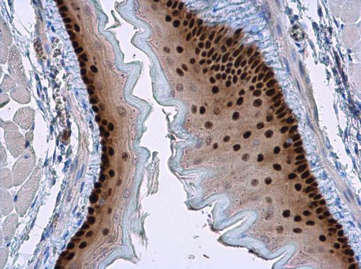 SOX2 Antibody in Immunohistochemistry (Paraffin) (IHC (P))